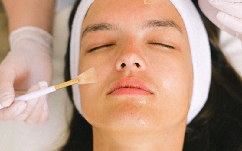 5 Best Medspa Treatments for Hyperpigmentation and Dark Spots