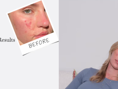 Face Reality Acne Clinic