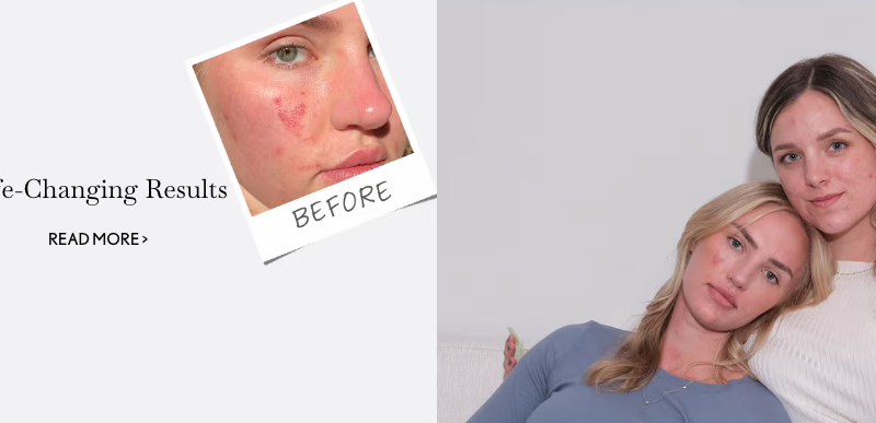 Face Reality Acne Clinic